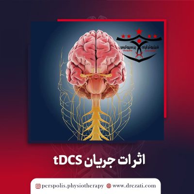 اثرات جریان tDCS دو طرفه روی عملکرد زبانی بیماران مبتلا به آفازی بروکا