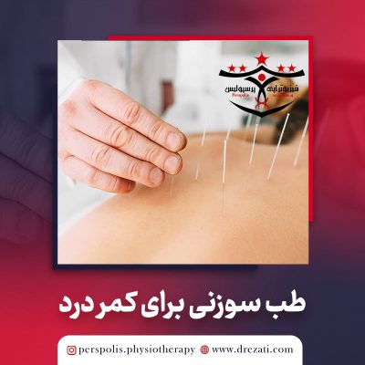 طب سوزنی برای کمر درد : درای نیدلینگ عضله مولتی فیدوس
