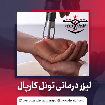 لیزر درمانی پرتوان برای سندروم تونل کارپال (CTS)