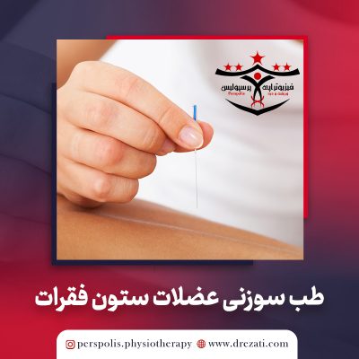 طب سوزنی خشک dry needling عضلات ستون فقرات