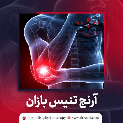 آرنج تنیس بازان (Tennis Elbow)