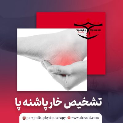 نحوه تشخیص و نشانه های خارپاشنه