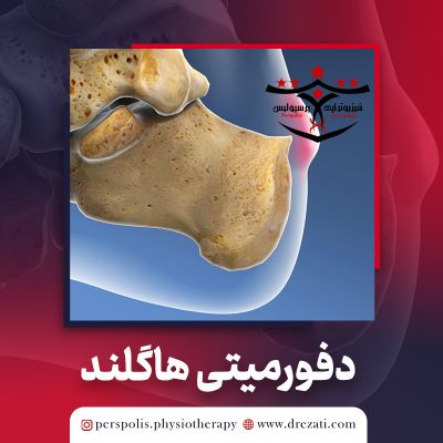 دفورمیتی هاگلند