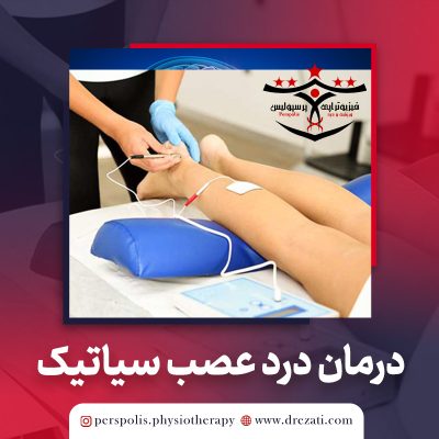 درمان درد عصب سیاتیک با فیزیوتراپی