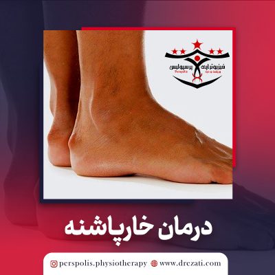 درمان خارپاشنه با فیزیوتراپی