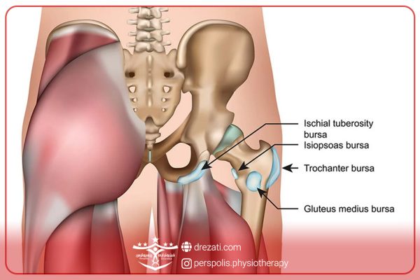 علل رایج درد مفصل ران چیست ؟