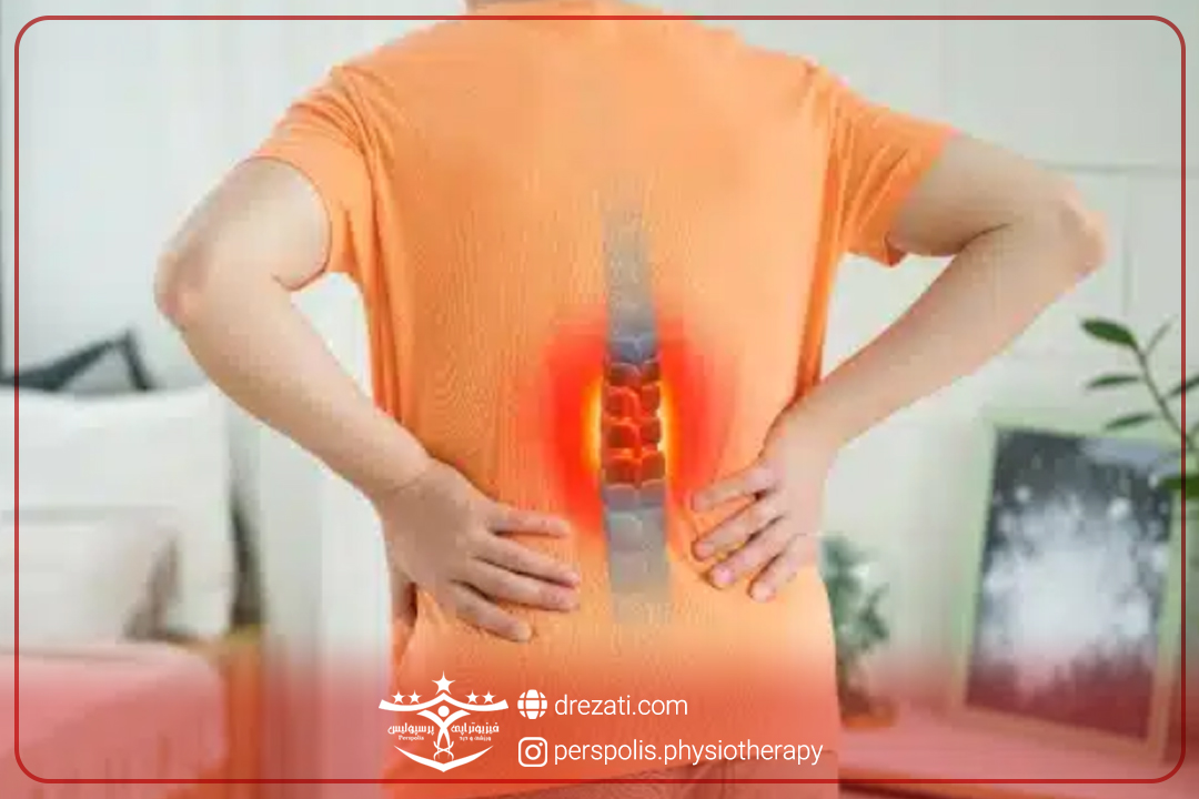 درجات بیرون زدگی دیسک کمر