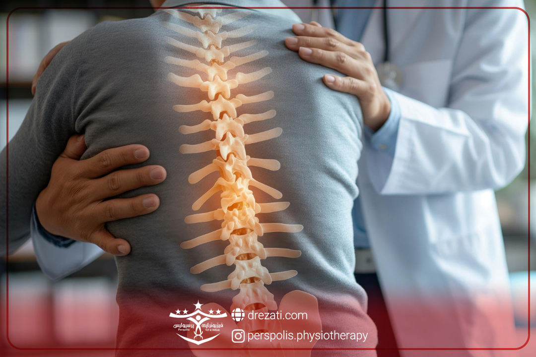 تنگی کانال نخاعی کمر