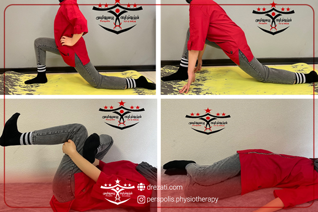 نشانه های بیمار در انواع بیرون زدگی دیسک کمر