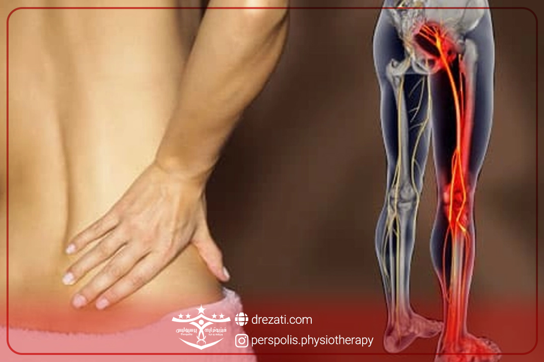 دیسک کمر و درد پا