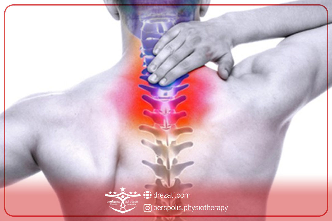 انواع بیرون زدگی دیسک گردن