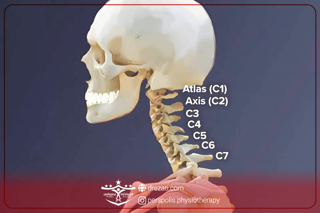 نشانه های بیمار در انواع بیرون زدگی دیسک گردن