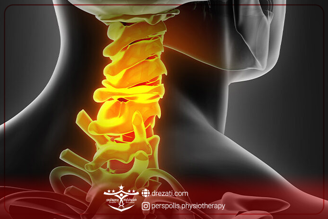 فرق دیسک گردن و کمر