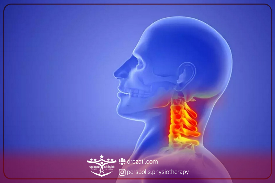 احتیاطات دیسک گردن