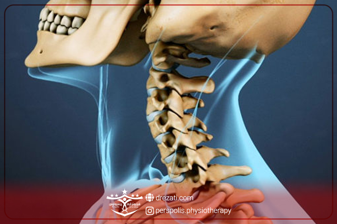جراحی دیسک گردن؛ راهنمایی جامع برای بیماران