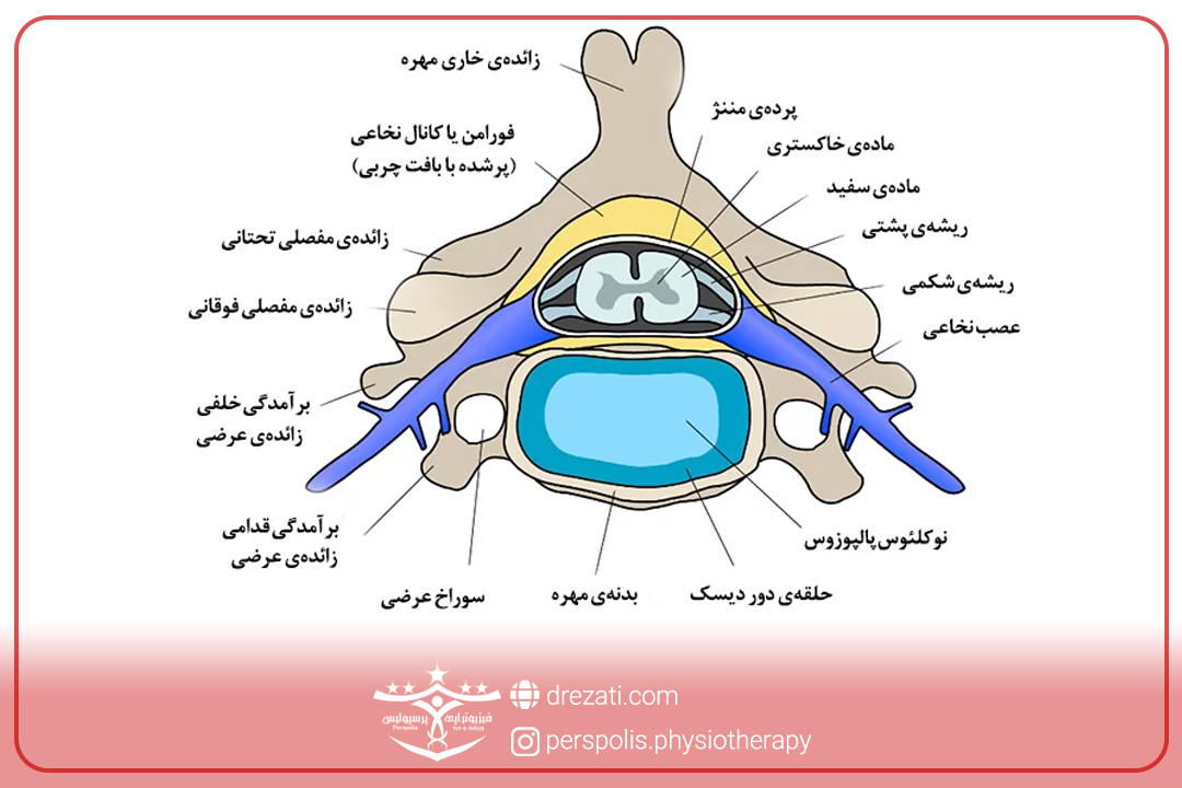 محتویات دیسک گردن