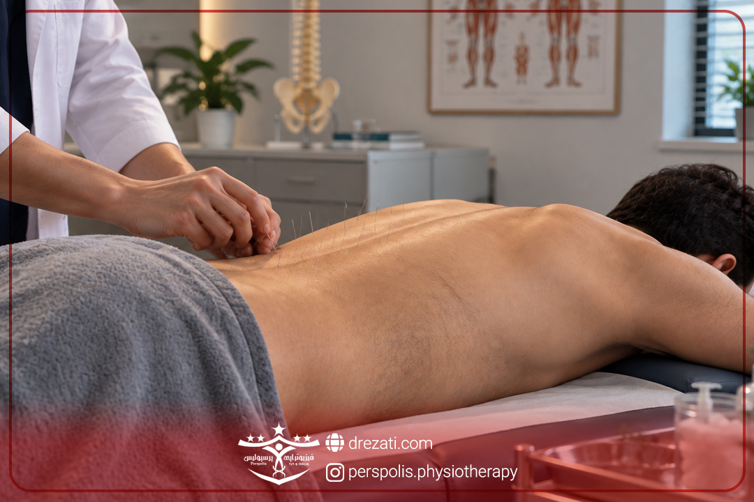 طب سوزنی در رشت