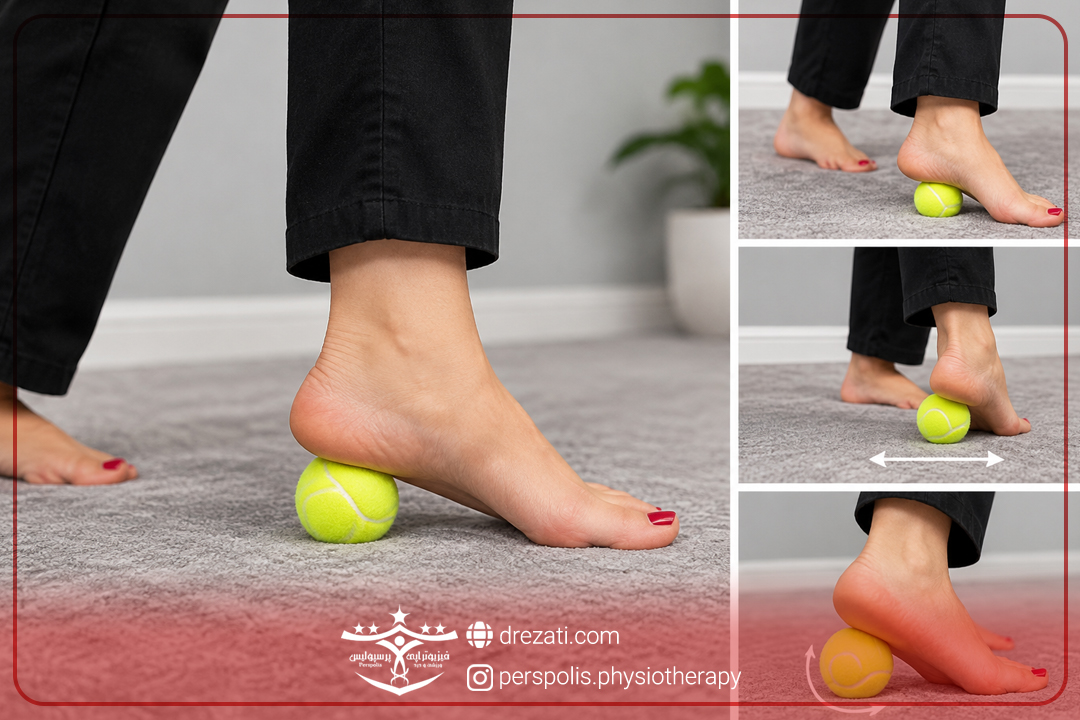 شاک ویو خارپاشنه در رشت