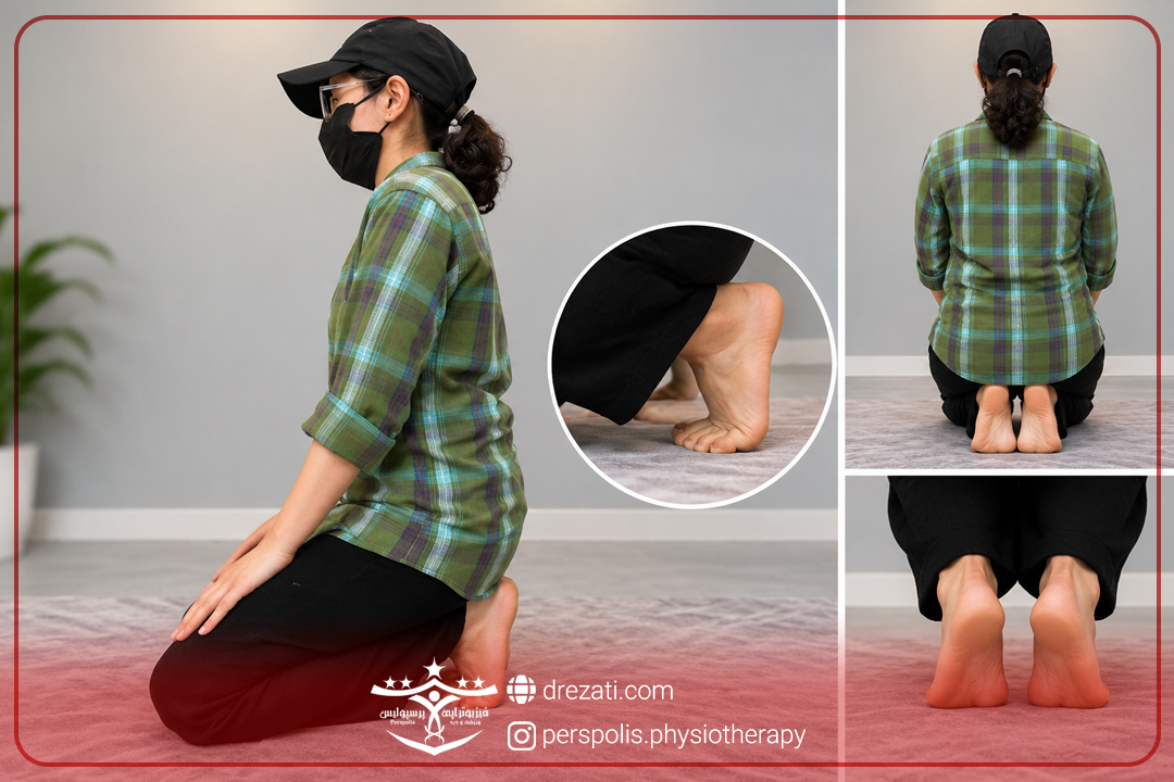 شاک ویو خارپاشنه در رشت