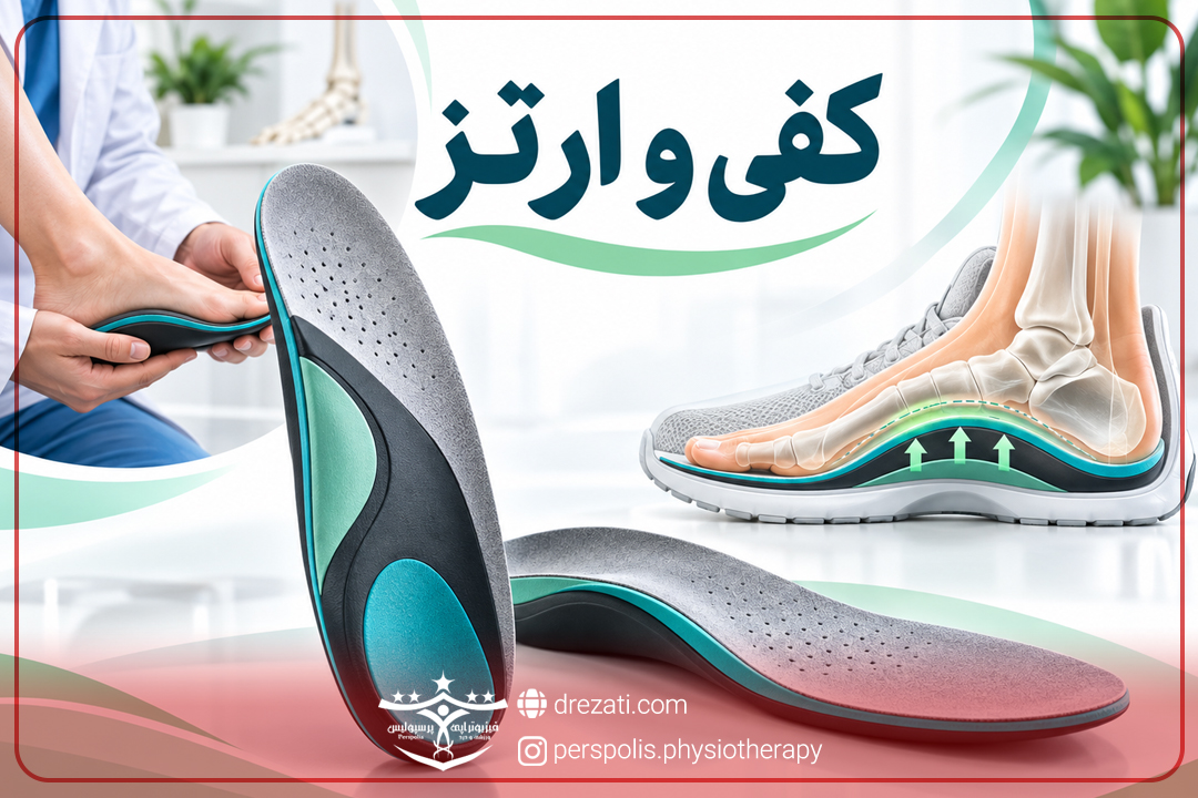 درمان صافی کف پا در رشت
